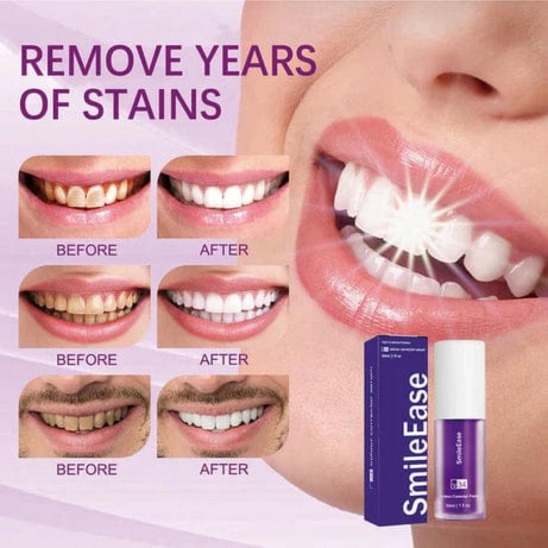 HiSmile V34 Effective Whitening Toothpaste